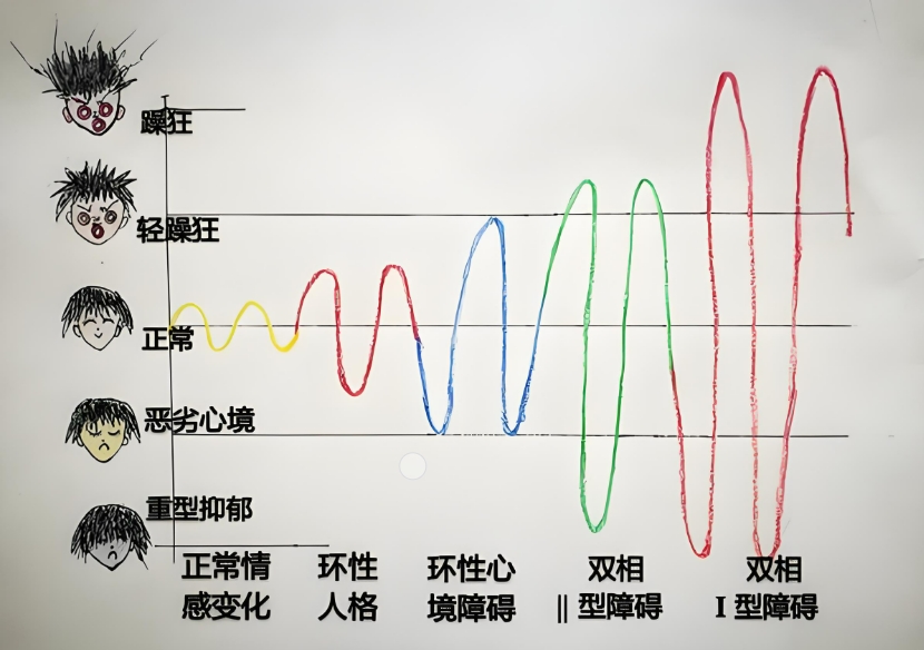 双相情感障碍测试量表(MDQ)